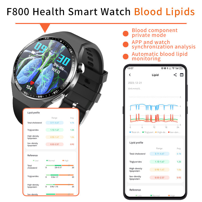 ECG+PPG Diabetic Smartwatch – Sport & Fitness